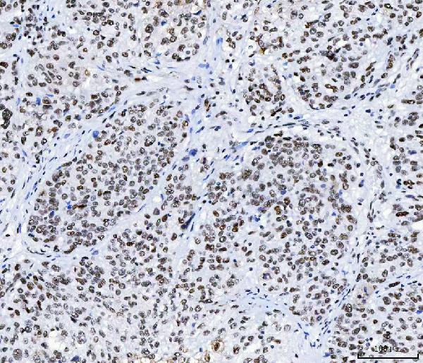 IHC - Anti-CPSF6 Antibody Picoband™ (monoclonal, 3F11E1) ABO16592